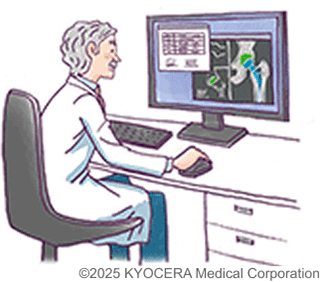 術前計画とナビゲーションシステム