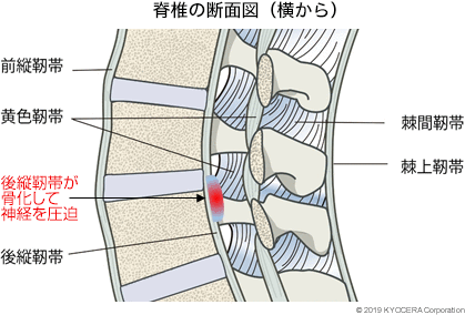 脊椎の断面図（横から）