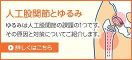 人工股関節とゆるみ　ゆるみは人工股関節の課題の1つです。その原因と対策についてご紹介します。